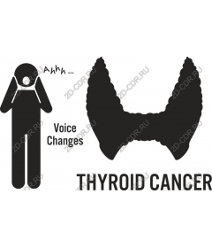  Awareness about thyroid cancer