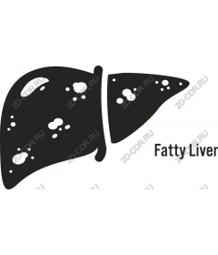 Fatty liver