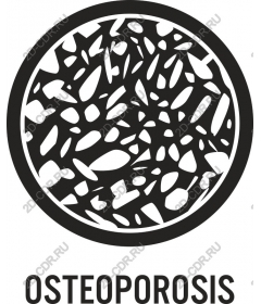  Остеопороз
