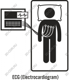  ECG (Electrocardiogram)