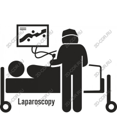  Laparoscopy