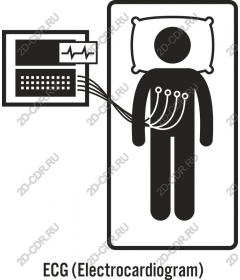  ECG (Electrocardiogram)