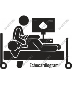 Процедура эхокардиограммы