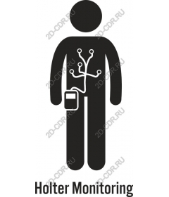  Holter monitoring