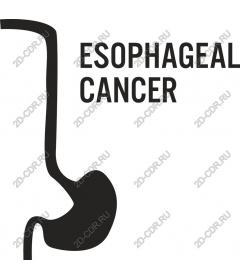  Awareness of cancer of the esophagus