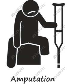 Amputation