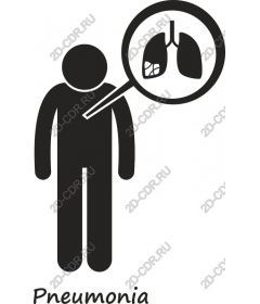  Awareness about pneumonia