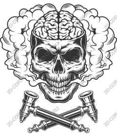  Acute skull with the brain