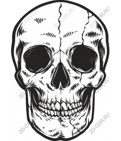  Cracked skull