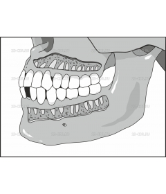 CUTJAWS