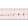 Векторный клипарт «EKG1»